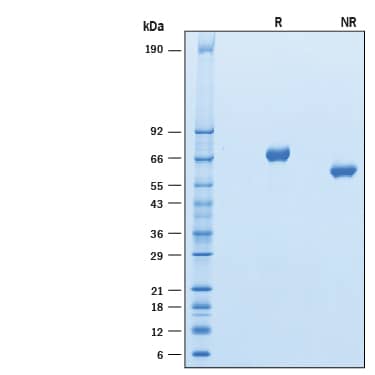 2 µg/lane of Recombinant Human Kirrel 1/NEPH1 His-tag (Catalog # 10165-K1) was resolved with SDS-PAGE under reducing (R) and non-reducing (NR) conditions and visualized by Coomassie® Blue staining, showing major bands at 65-75 kDa and 50-60 kDa, respectively.