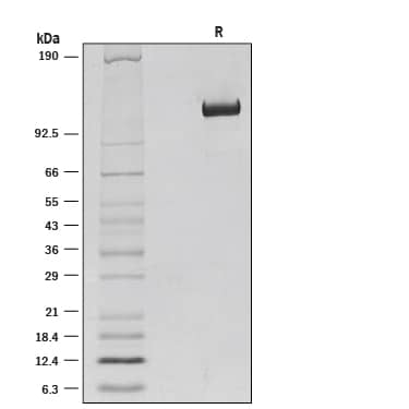 1 μg/lane of Recombinant Mouse Klotho  beta  was resolved with SDS-PAGE under reducing (R) conditions and visualized by silver staining, showing a band at 135 kDa.