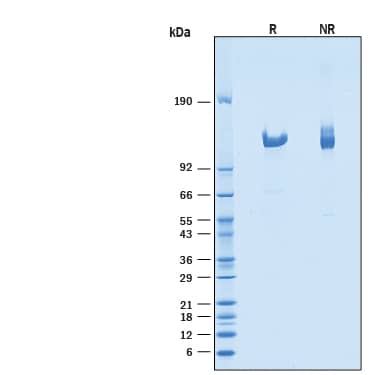 1 μg/lane of Recombinant Human Klotho  beta  was resolved with SDS-PAGE under reducing (R)  and non-reducing (NR) conditions and visualized by Coomassie® Blue staining, showing a single band at 113-125 kDa.