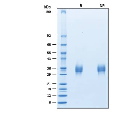 2 μg/lane of Recombinant Human LAIR1 His-tag Avi-tag (Catalog # AVI2664) was resolved with SDS-PAGE under reducing (R) and non-reducing (NR) conditions and visualized by Coomassie® Blue staining, showing bands at 25-38 kDa.