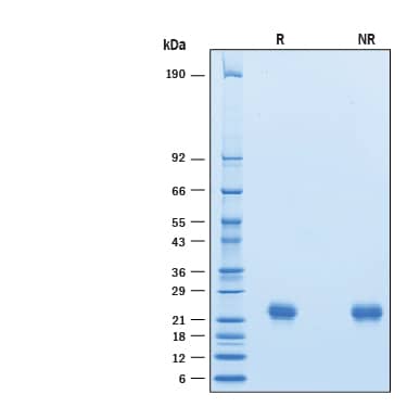 2 μg/lane of Biotinylated Recombinant Human LAIR2 His-Tag Avi-tag (Catalog # AVI2665) was resolved with SDS-PAGE under reducing (R) and non-reducing (NR) conditions and visualized by Coomassie® Blue staining, showing bands at 20-28 kDa.