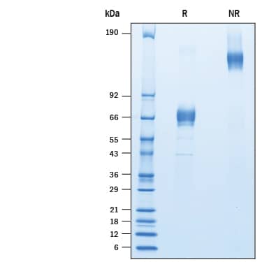 2 μg/lane of Recombinant Human LRRC52 Fc Chimera (Catalog # 10260-LR) was resolved with SDS-PAGE under reducing (R) and non-reducing (NR) conditions and visualized by Coomassie® Blue staining, showing bands at 60-80 kDa and 120 -140 kDa, respectively.