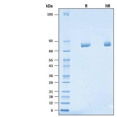 SDS-Page LRRN2 [Unconjugated]