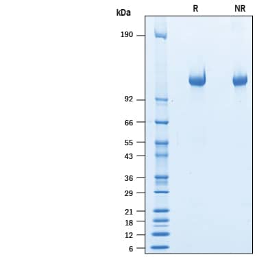 2 μg/lane of Recombinant Human LRRN4 His-tag (Catalog # 10227-LR) was resolved with SDS-PAGE under reducing (R) and non-reducing (NR) conditions and visualized by Coomassie® Blue staining, showing bands at 106-123 kDa.