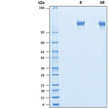 SDS-Page LRRN4 [Unconjugated]