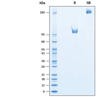 2 μg/lane of Recombinant Human LRRTM1 Fc Chimera (Catalog # 10372-LR) was resolved with SDS-PAGE under reducing (R) and non-reducing (NR) conditions and visualized by Coomassie® Blue staining, showing bands at 99-109 and 190-210 kDa, respectively.