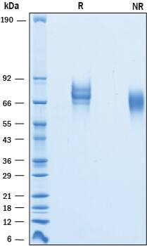 2 μg/lane of Recombinant Mouse L‑Selectin/CD62L was resolved with SDS-PAGE under reducing (R) and non-reducing (NR) conditions and visualized by Coomassie® Blue staining, showing bands at 62-83 kDa.