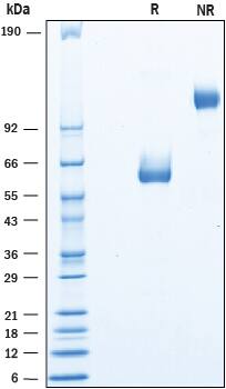 SDS-Page LYPD6 [Unconjugated]