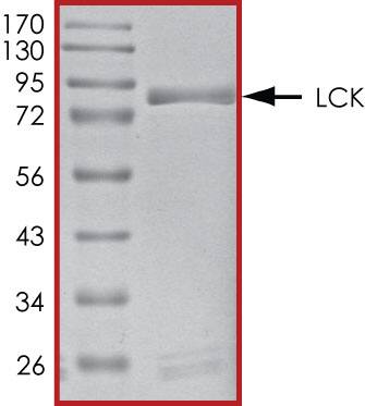 The approximate molecular weight is 84 kDa and the purity is > 95%.