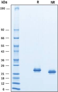 2 μg/lane of Recombinant Cynomolgus Monkey Lipocalin‑2/NGAL was resolved with SDS-PAGE under reducing (R) and non-reducing (NR) conditions and visualized by Coomassie® Blue staining, showing a primary band at 24 kDa under reducing conditions.