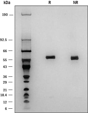 1 μg/lane of Recombinant Human Lipoprotein Lipase was resolved with SDS-PAGE under reducing (R) and non-reducing (NR) conditions and visualized by silver staining, showing a band at 60 kDa.