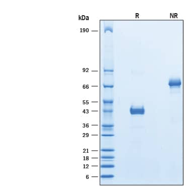 2 μg/lane of Recombinant Human Ly6D Fc Chimera (Catlog # 10169-L6) was resolved with SDS-PAGE under reducing (R) and non-reducing (NR) conditions and visualized by Coomassie® Blue staining, showing bands at 38-46 kDa and 80-90 kDa, respectively.