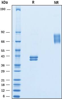 SDS-Page Ly-6E [Unconjugated]