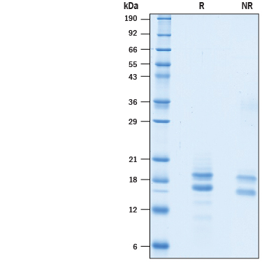 2 μg/lane of Recombinant Human Ly6H His-tag Protein (Catalog # 10373-L6) was resolved with SDS-PAGE under reducing (R) and non-reducing (NR) conditions and visualized by Coomassie® Blue staining, showing bands at 13-25 kDa.