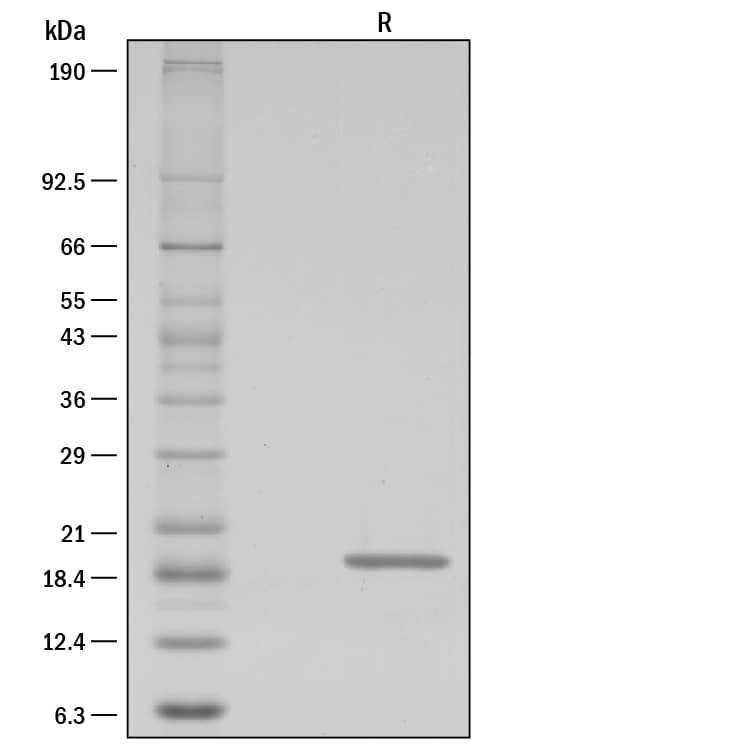 SDS-Page Lymphotoxin-alpha/TNF-beta [Unconjugated]