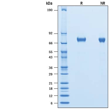 2 μg/lane of Recombinant Human Lymphotoxin alpha1/beta2 His-tag Avi-tag (Catalog # AVI8884) was resolved with SDS-PAGE under reducing (R) and non-reducing (NR) conditions and visualized by Coomassie® Blue staining, showing bands at 69-80 kDa.