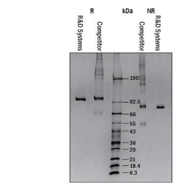 1 μg/lane of Recombinant Human Lysyl Oxidase Homolog 2 (Catalog # 2639-AO) and 1 μg/lane of competitor Lysyl Oxidase Homolog 2 were resolved with 4-20% SDS-PAGE under reducing (R) and non-reducing (NR) conditions and visualized by silver staining.