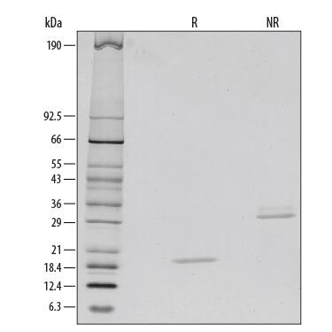 1 μg/lane of Recombinant Human M-CSF was resolved with SDS-PAGE under reducing (R) and non-reducing (NR) conditions and visualized by silver staining, showing bands at 19 kDa and 35 kDa, respectively.