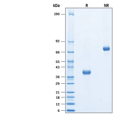 2 μg/lane of Recombinant Human MFAP4 (Catalog # 10230-MF) was resolved with SDS-PAGE under reducing (R) and non-reducing (NR) conditions and visualized by Coomassie® Blue staining, showing bands at 35-45 kDa and 70-90 kDa, respectively.
