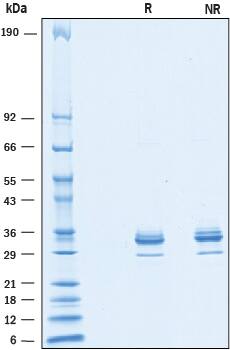 2 μg/lane of Recombinant Human Mesothelin N-Terminal (aa 35-289) His-tag (Catalog# 10093-MS) was resolved with SDS-PAGE under reducing (R) and non-reducing (NR) conditions and visualized by Coomassie® Blue staining, showing bands at 27-39 kDa.