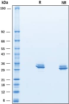 SDS-Page Myocilin [Unconjugated]