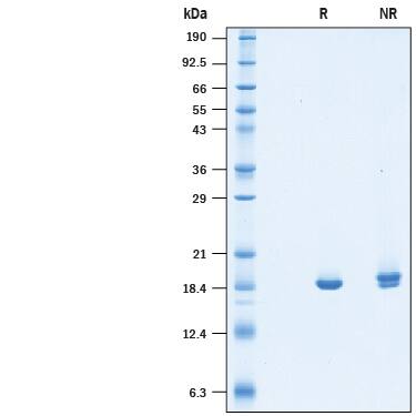 2 μg/lane of Recombinant Human NM23-H2 His-tag (Catalog # 10466-NM) was resolved with SDS-PAGE under reducing (R) and non-reducing (NR) conditions and visualized by Coomassie® Blue staining, showing a band at 19 kDa under reducing conditions.