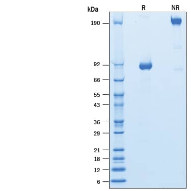SDS-Page Natriuretic Peptide Receptor C [Unconjugated]