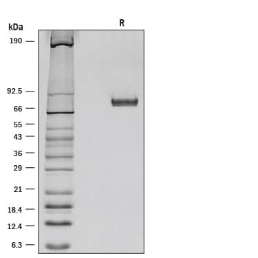 SDS-Page Netrin-1 [Unconjugated]
