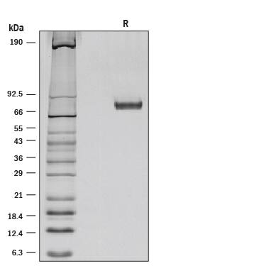 1 μg/lane of Recombinant Mouse Netrin-1 was resolved with SDS-PAGE under reducing (R) conditions and visualized by silver staining, showing a band at 83 kDa.