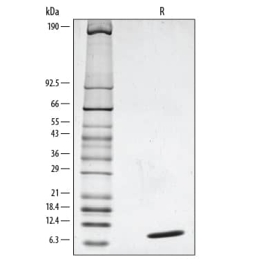 SDS-Page Neuregulin-1 beta 1/NRG1 beta 1 [Unconjugated]