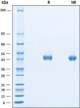 SDS-Page Neuregulin-1/NRG1 [Unconjugated]