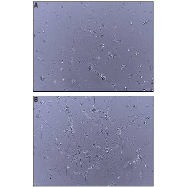 Bioactivity Neuroligin 4Y/NLGN4Y [Unconjugated]