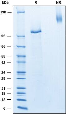2μg/lane of Recombinant Human Notch‑4 was resolved with SDS-PAGE under reducing (R) and non-reducing (NR) conditions and visualized by Coomassie® Blue staining, showing bands at 94-116 kDa and 170-200 kDa, respectively.