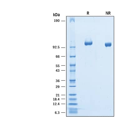 2 μg/lane of Recombinant Mouse OCAM/NCAM2 His-tag (Catalog # 10154-CM) was resolved with SDS-PAGE under reducing (R) and non-reducing (NR) conditions and visualized by Coomassie® Blue staining, showing bands at 95-110 kDa.