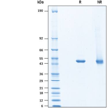SDS-Page Ornithine Decarboxylase [Unconjugated]