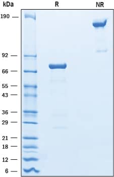 2 μg/lane of Recombinant Mouse OLT-2/TARM1 Fc Chimera was resolved with SDS-PAGE under reducing (R) and non-reducing (NR) conditions and visualized by Coomassie® Blue staining, showing bands at 70-80 kDa and 140-160 kDa, respectively.