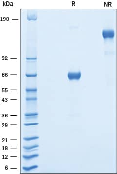 2 μg/lane of Recombinant Human OSCAR was resolved with SDS-PAGE under reducing (R) and non-reducing (NR) conditions and visualized by Coomassie® blue staining, showing bands at 61-70 kDa and 120-140 kDa, respectively.