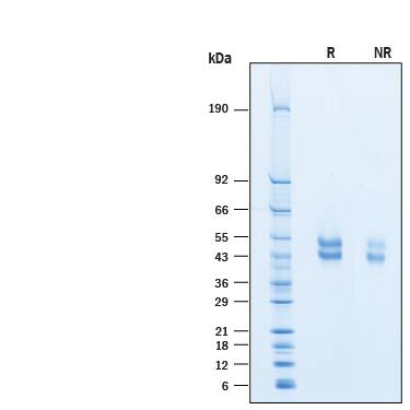 2 μg/lane of Recombinant Cynomolgus Monkey OX40/TNFRSF4 His-tag (Catalog # 10137-OX) was resolved with SDS-PAGE under reducing (R) and non-reducing (NR) conditions and visualized by Coomassie® Blue staining, showing bands at 40-55 kDa.