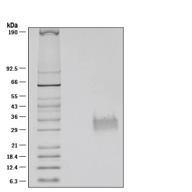1 μg/lane of Recombinant Human OX40 Ligand/TNFSF4 was resolved with SDS-PAGE under reducing (R) conditions and visualized by silver staining, showing bands at 28-34 kDa.