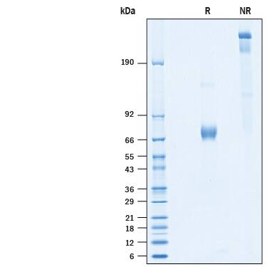 2 μg/lane of Recombinant Human Olfactomedin-4/OLFM4 His-tag (Catalog # 10261-OL) was resolved with SDS-PAGE under reducing (R) and non-reducing (NR) conditions and visualized by Coomassie® Blue staining, showing bands at 66-75 kDa on reducing gel.