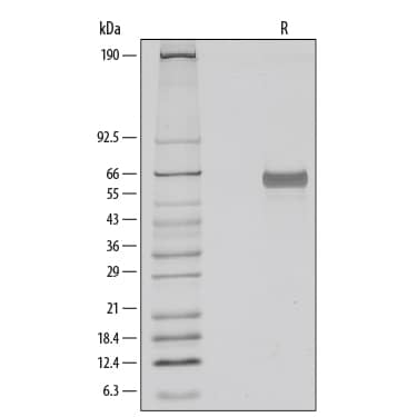 1 μg/lane of Recombinant Human Osteopontin/OPN was resolved with SDS-PAGE under reducing (R) conditions and visualized by silver staining, showing a bands at 60-65 kDa.