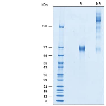 SDS-Page Otolin-1 [Unconjugated]