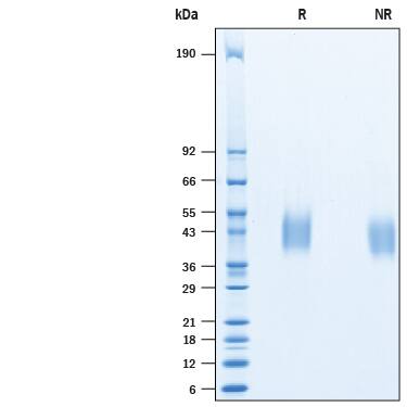 2 μg/lane of Recombinant Porcine PD-1 His-tag Protein (Catalog # 10432-PD) was resolved with SDS-PAGE under reducing (R) and non-reducing (NR) conditions and visualized by Coomassie® Blue staining, showing bands at 36-48 kDa.