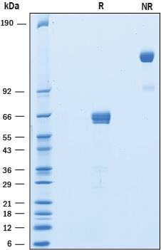 2 μg/lane of Recombinant Rat PD‑1 was resolved with SDS-PAGE under reducing (R) and non-reducing (NR) conditions and visualized by Coomassie® blue staining, showing bands at 57-70 kDa and 110-140 kDa, respectively.