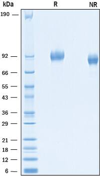 2 μg/lane of Recombinant Mouse PDGF R alpha  was resolved with SDS-PAGE under reducing (R) and non-reducing (NR) conditions and visualized by Coomassie® Blue staining, showing bands at 86-97 kDa.