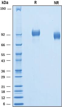 2 μg/lane of Recombinant Mouse PDGF R beta  was resolved with SDS-PAGE under reducing (R) and non-reducing (NR) conditions and visualized by Coomassie® Blue staining, showing bands at 89-103 kDa.