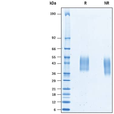 2 μg/lane of Recombinant Porcine PD-L1/B7-H1 His-tag (Catalog # 10361-B7) was resolved with SDS-PAGE under reducing (R) and non-reducing (NR) conditions and visualized by Coomassie® Blue staining, showing bands at 35-55 kDa.