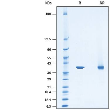 2 μg/lane of Recombinant Human PSAT1 His-tag (Catalog # 10342-PS) was resolved with SDS-PAGE under reducing (R) and non-reducing (NR) conditions and visualized by Coomassie® Blue staining, showing a band at 40 kDa under reducing conditions.