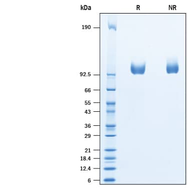 SDS-Page PSMA/FOLH1/NAALADase I [Biotin]