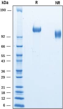 2 μg/lane of Recombinant Mouse P‑Selectin/CD62P His-tag (Catalog # 10094-PS) was resolved with SDS-PAGE under reducing (R) and non-reducing (NR) conditions and visualized by Coomassie® Blue staining, showing bands at 105-125 kDa.